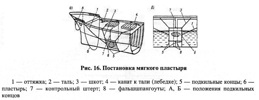 Постановка мягкого пластыря