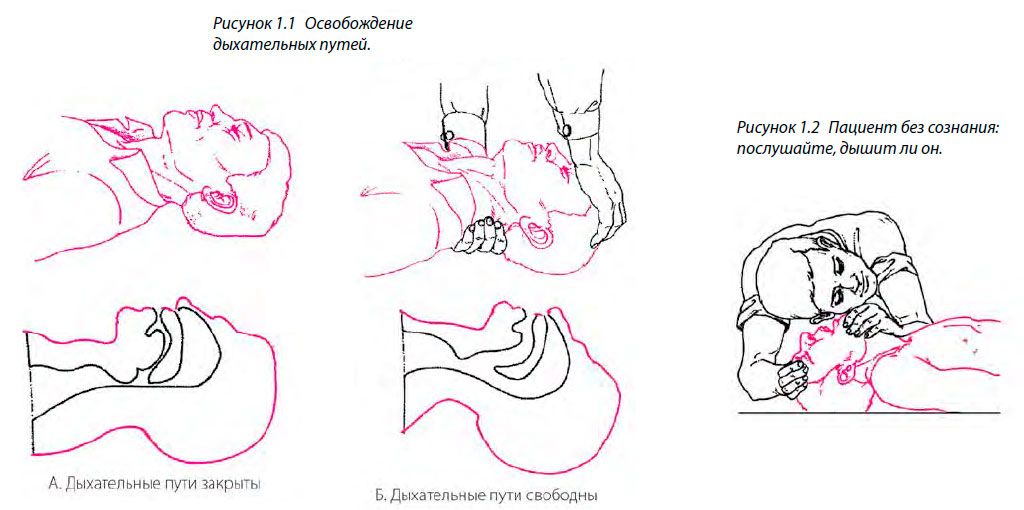 Освобождение дыхательных путей