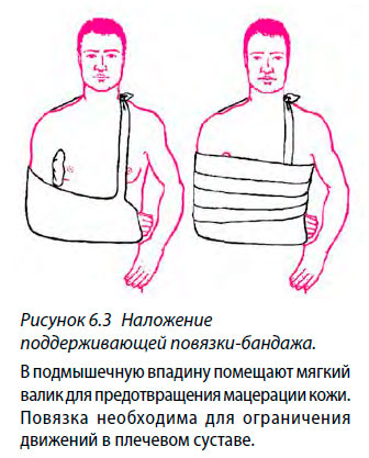 Наложение поддерживающей повязки-бандажа