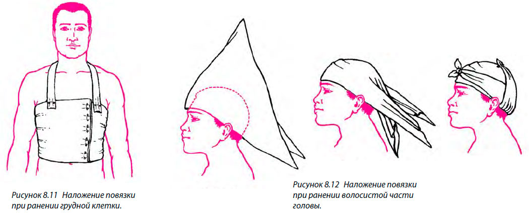 Наложение повязки при ранении волосистой части головы.