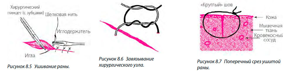 Поперечный срез ушитой раны