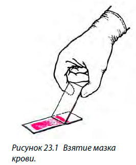 Взятие мазка крови.