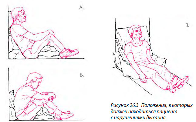 Положения, в которых
должен находиться пациент с нарушениями дыхания