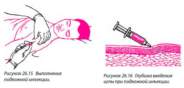 Выполнение
подкожной инъекции Глубина введения иглы при подкожной инъекции.