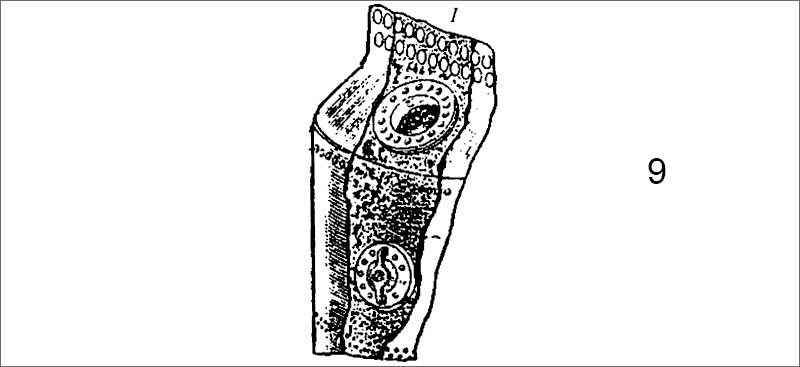 Сквозные повреждения корпуса
