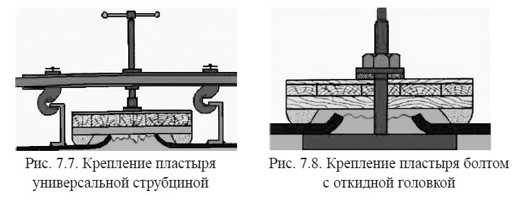 Крепление пластыря универсальной струбциной