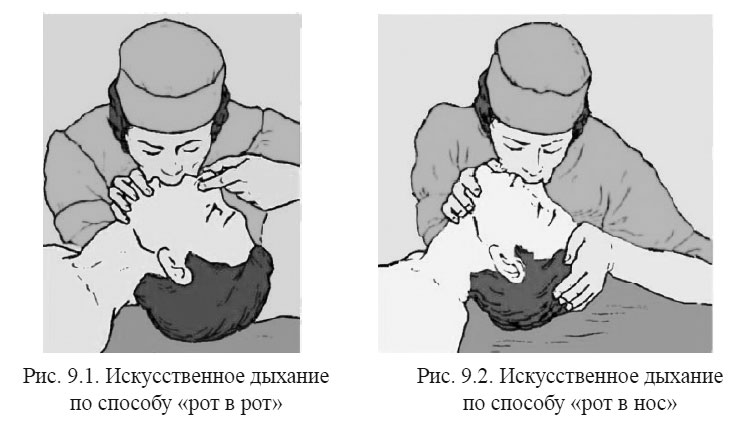 Искусственное дыхание по способу «рот в рот», Искусственное дыхание по способу «рот в нос»
